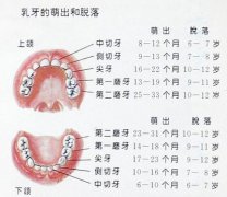 乳牙滞留拔不拔？