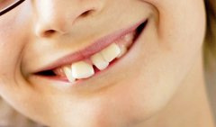 怎么区分龅牙是骨性还是牙性？