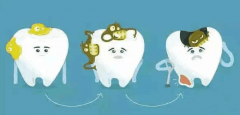 口腔急诊之急性牙髓炎问题处理方法