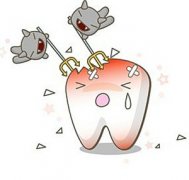 牙体楔状缺损病因